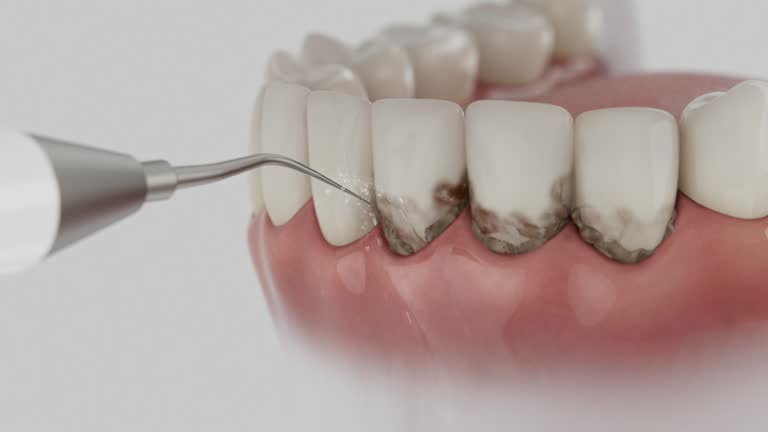 Trusted Tooth Extraction service in Mayflower, AR - Dentist Open Now